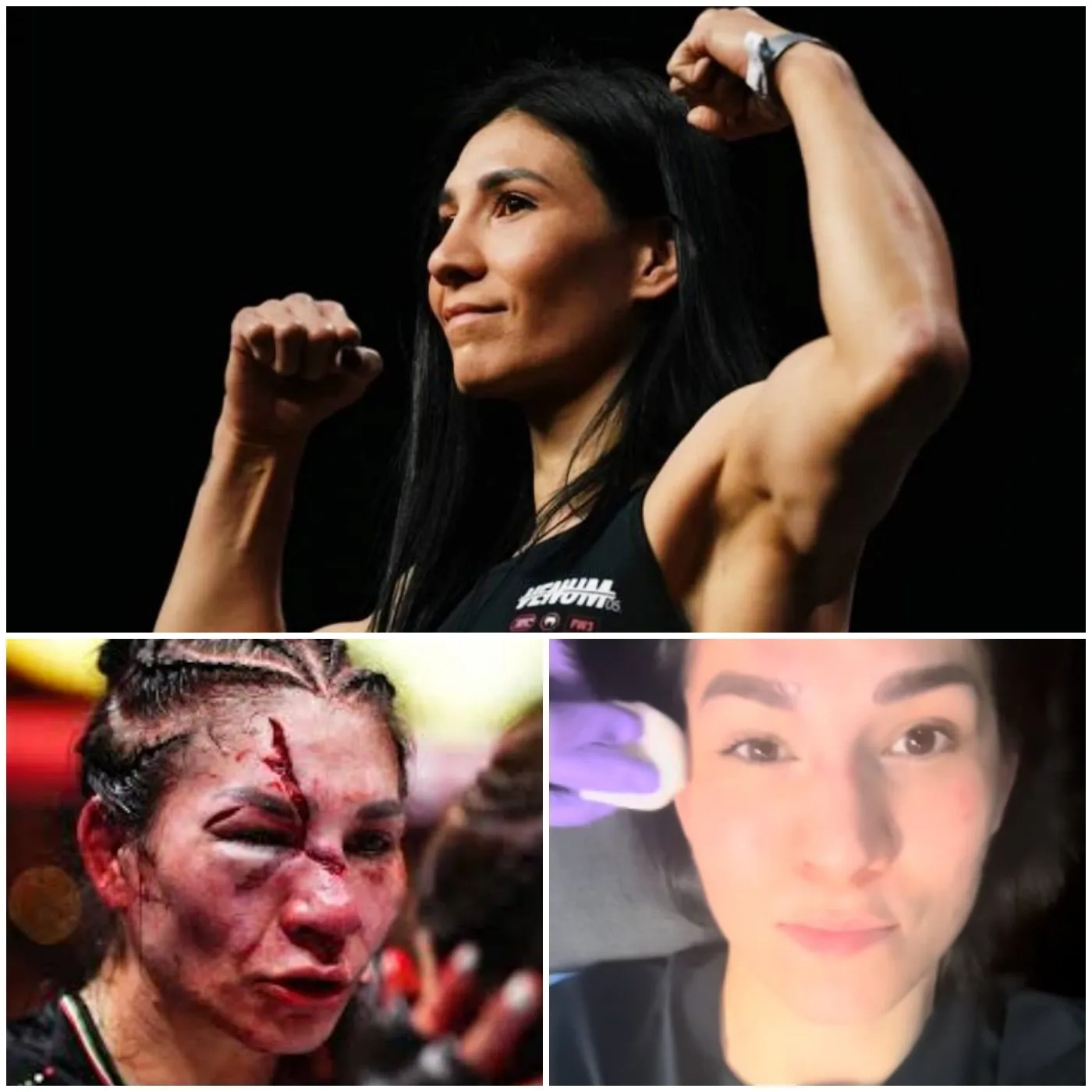 Irene Aldana’s miraculous recovery from UFC 306 facial injuries