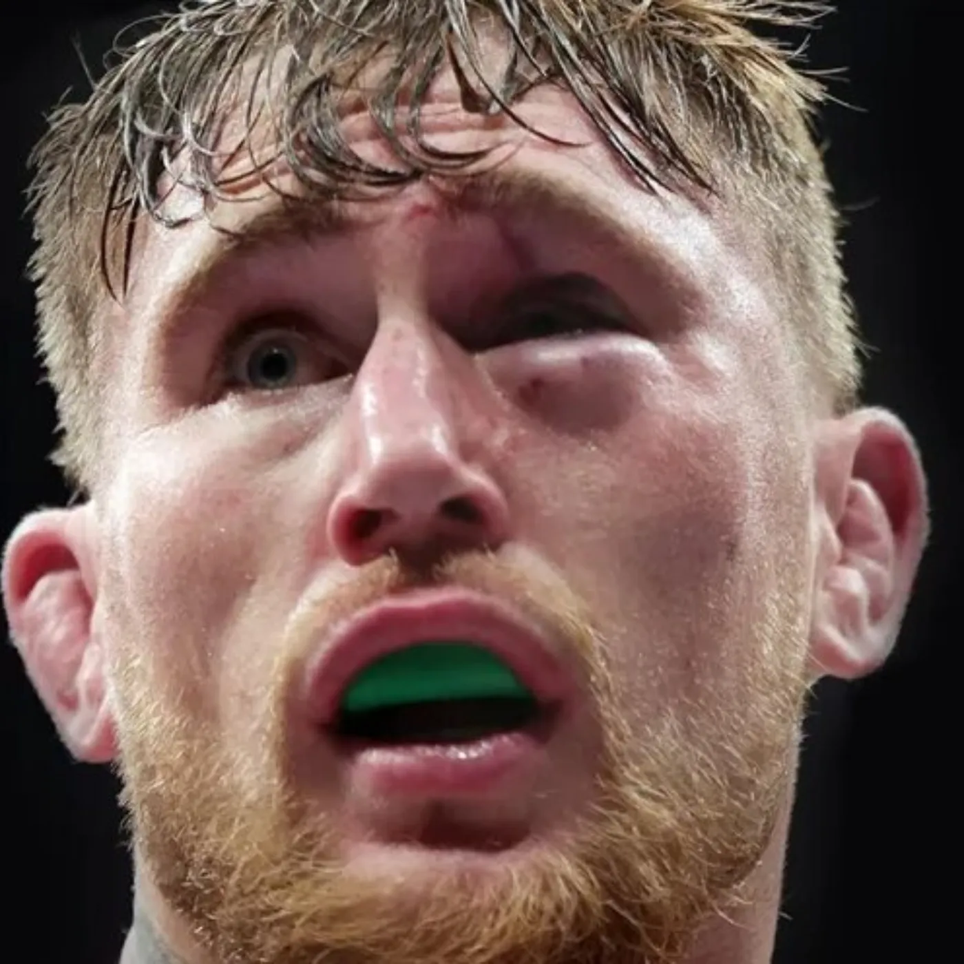 image_67515839ae565 The Tommy Fury-Jake Paul Showdown: A Champion’s Test of Legacy and Wealth