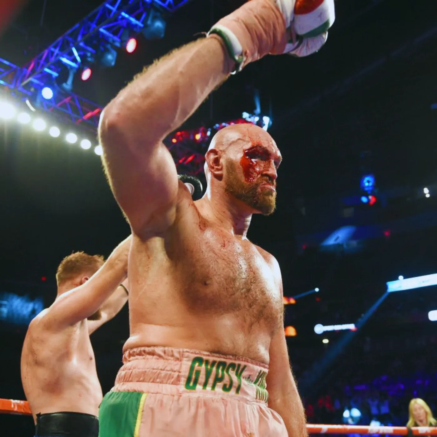 image_675a4030c3520 The Enigma of the Gypsy King: Unraveling the Mind of Tyson Fury