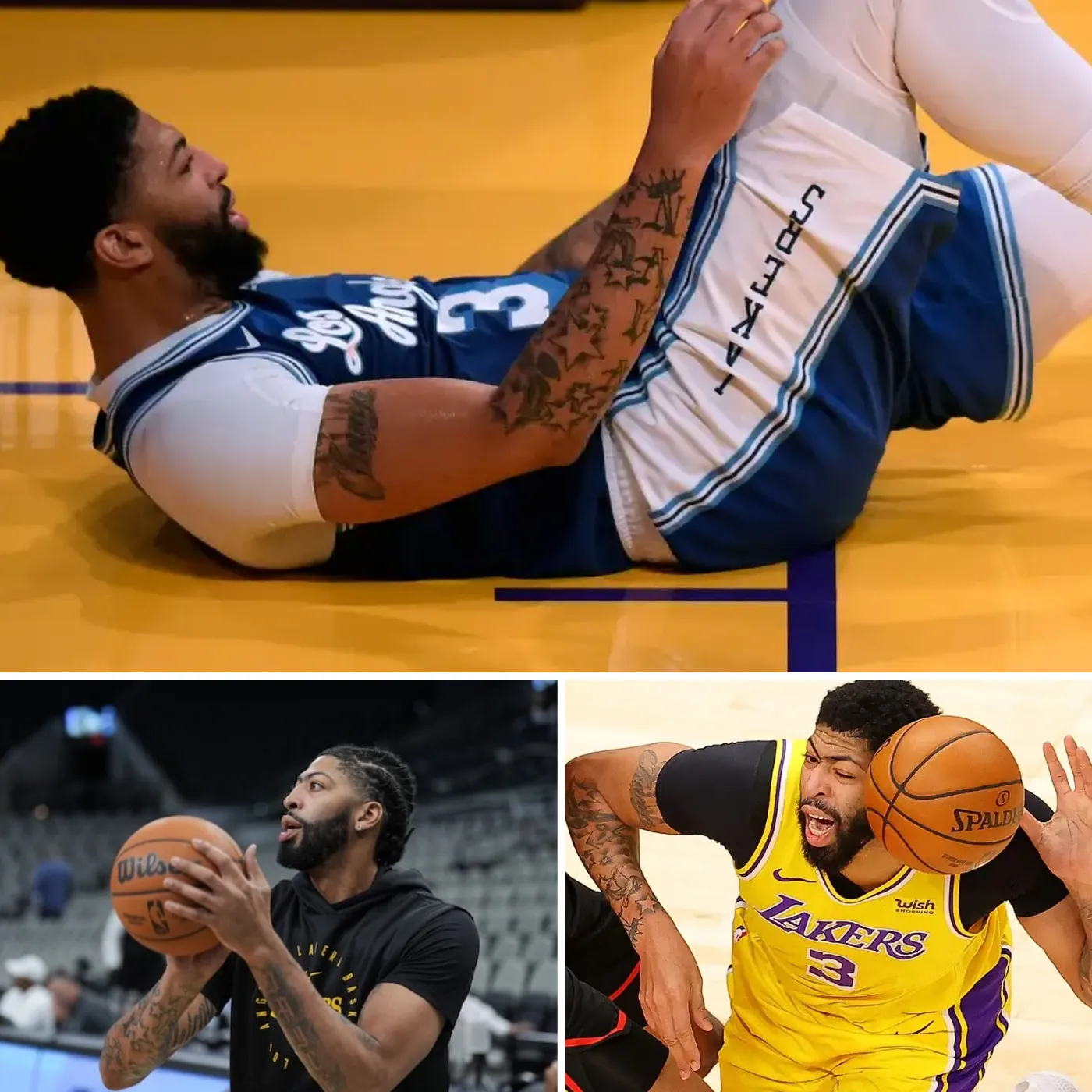 Anthony Davis’ Achilles Woes Keep Him Off the Court—Lakers Fans Start Asking – “When Will He Be Back?”