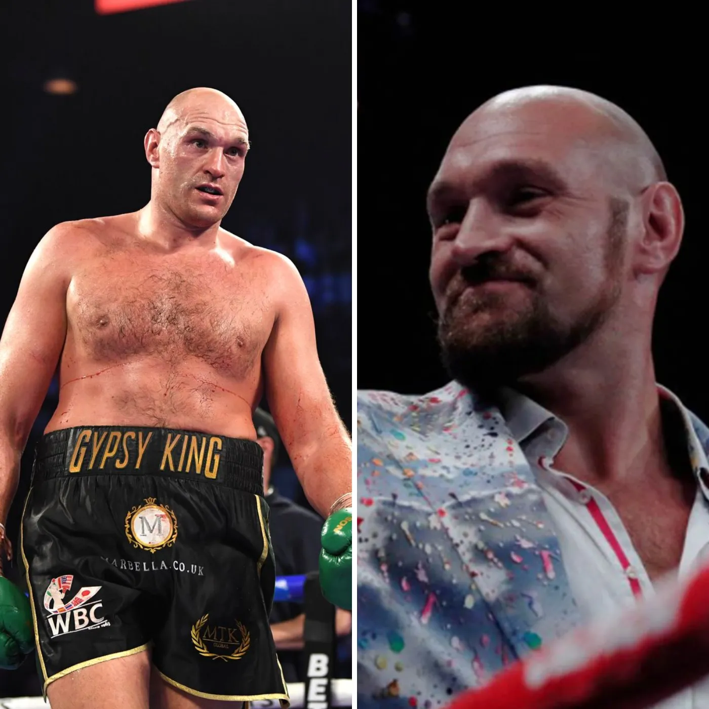 image_6760e44c24173 A Boxing Champion Whose Actions Lost Him Points In The Eyes Of Fans