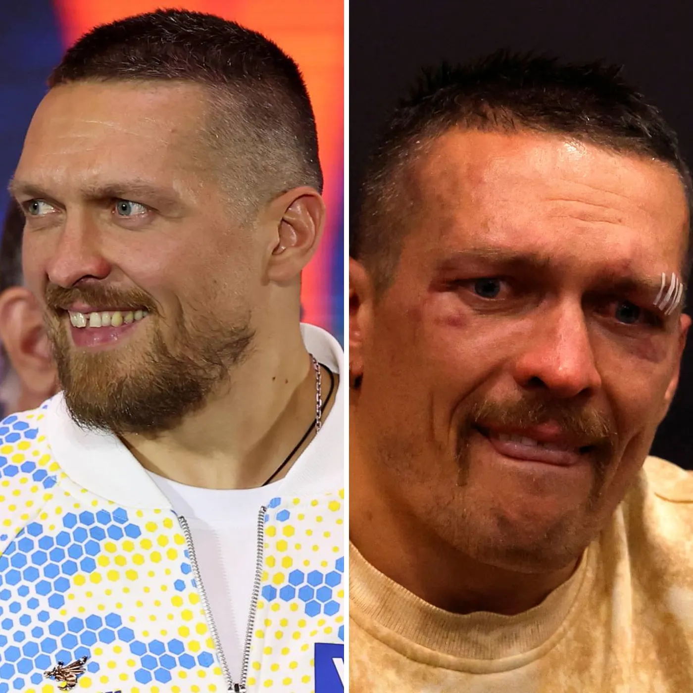 image_6760ff740df77 Shocking Reaction As Top Boxer’s Peers Support Rival In Rematch - "I Don't Need To Prove Anything"