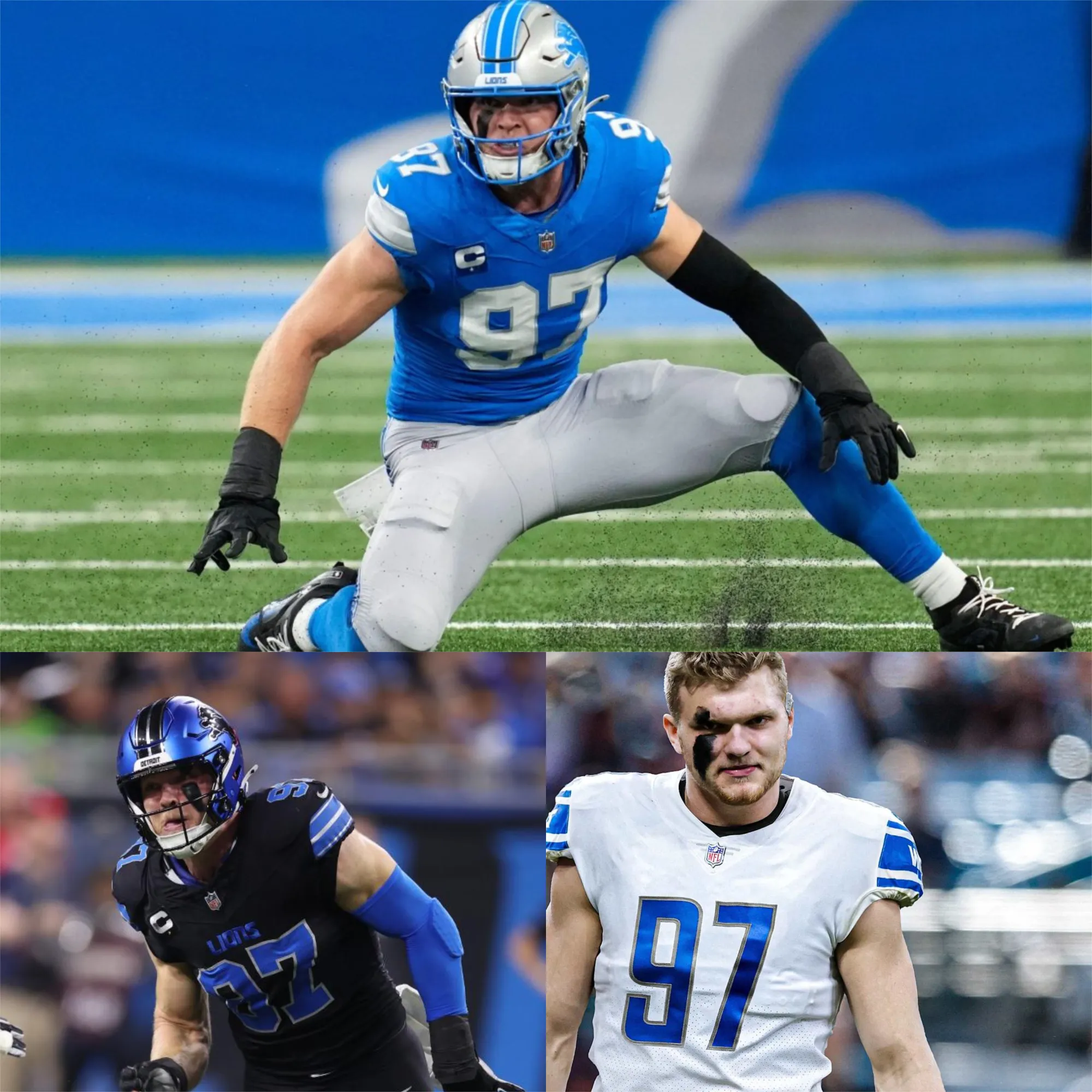 Aidan Hutchinson of the Detroit Lions Eyes Super Bowl Return Despite Injury Setback