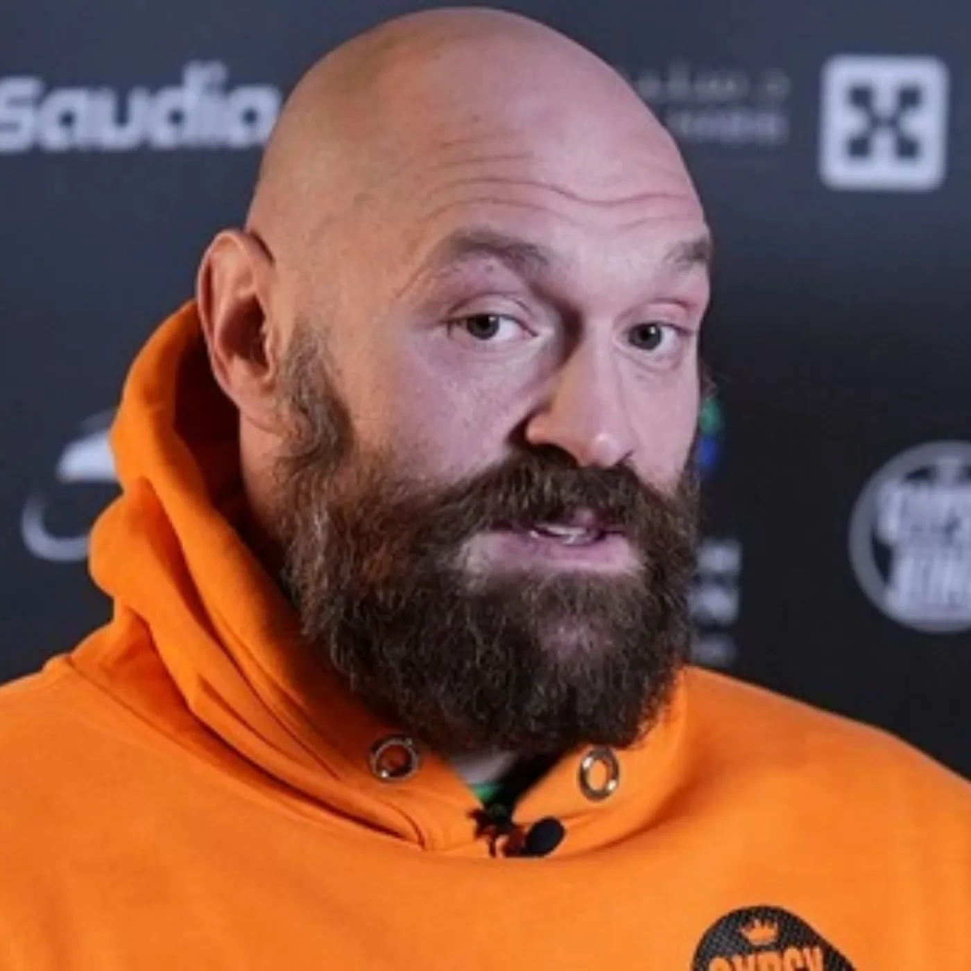 image_67661f56c9477 The Enigmatic Strength of Tyson Fury: Unraveling the Giant's Power