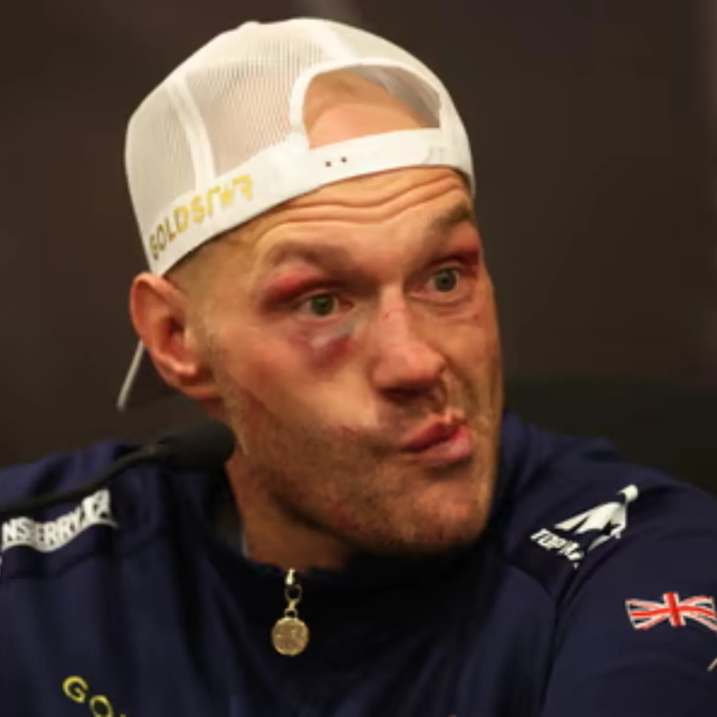 image_676620471d96d Osyk and Fury Tyson rematch are ready to step in the gamble for the winner.