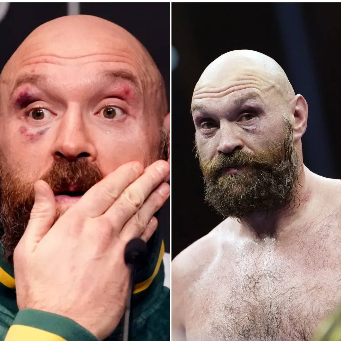 image_6768d20fd1910 Tyson Fury's Unstoppable Drive, Searching for Investors to Secure Rematch and Seek Revenge