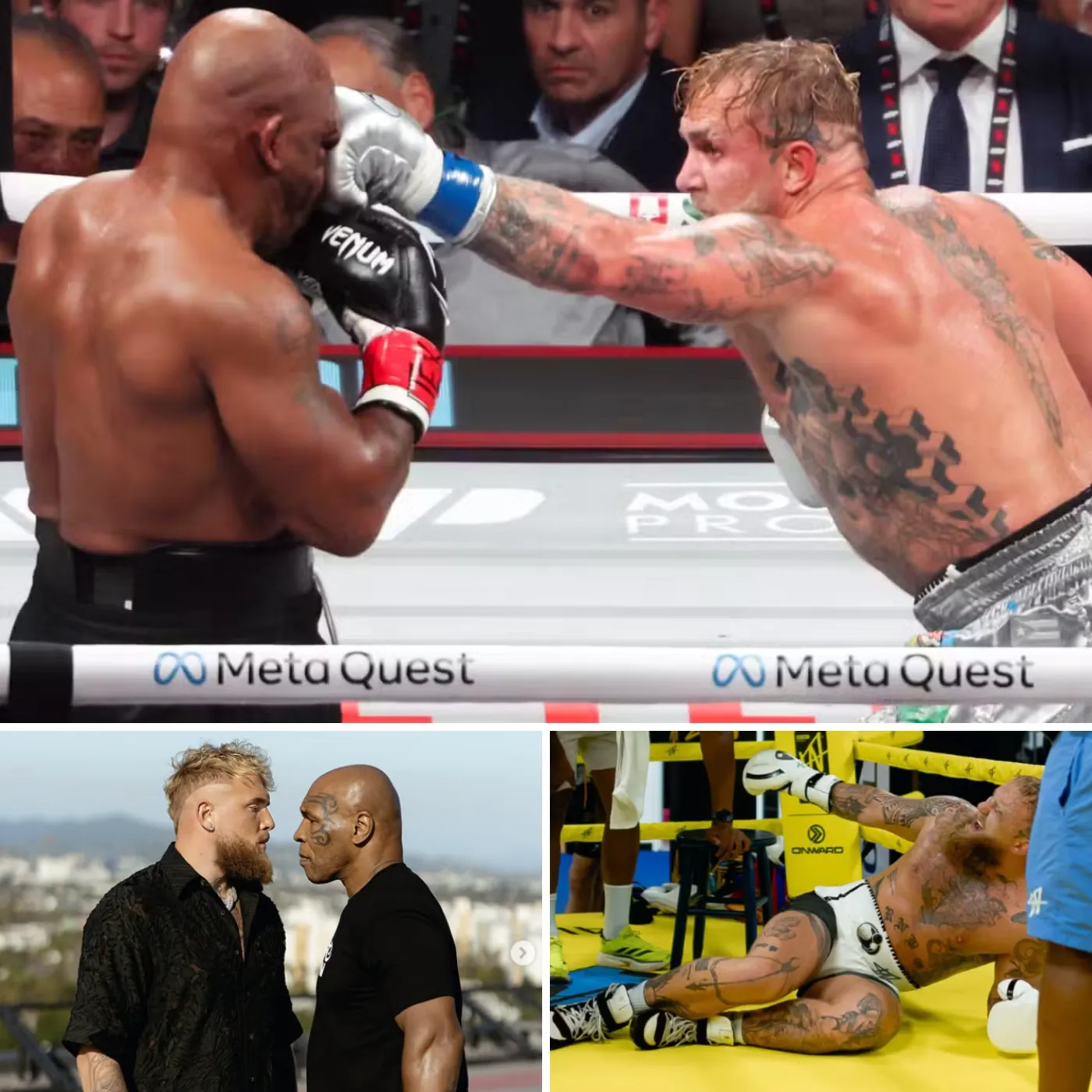 Jake Paul’s Fight Injury. The Horrific Injury That Could End His Dream of Fighting Mike Tyson read the full story below in the comments