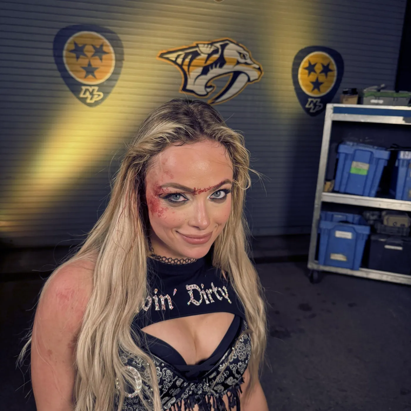 image_67b2070beb485 The Truth Behind Injury of Liv Morgan Exposes WWE’s Latest Controversial Move